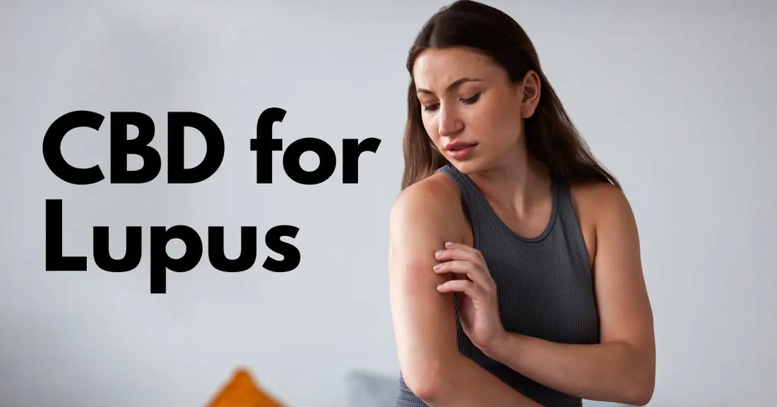 CBD for Lupus