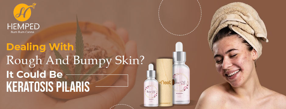 CBD For Acne