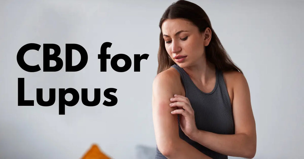 CBD for Lupus: Does it Actually Work?