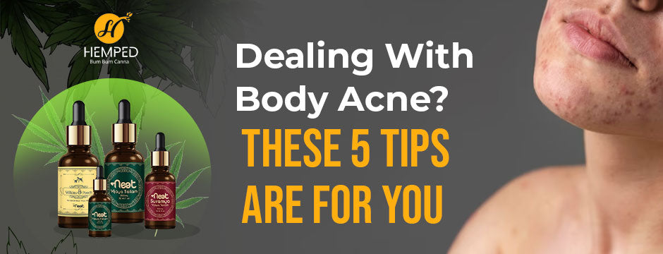 Dealing With Body Acne? These 5 Tips Are For You