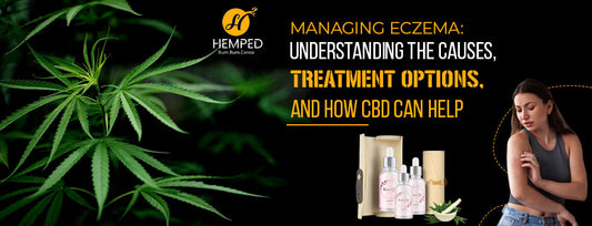 Managing Eczema: Understanding The Causes, Treatment Options, And How CBD Can Help