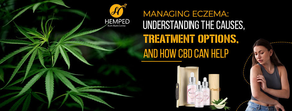 Managing Eczema: Understanding The Causes, Treatment Options, And How CBD Can Help