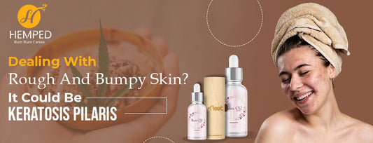 CBD for Acne: Can CBD Treat Keratosis Pillaris? - Urhemped