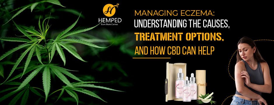 Managing Eczema: Understanding The Causes, Treatment Options, And How CBD Can Help - Urhemped