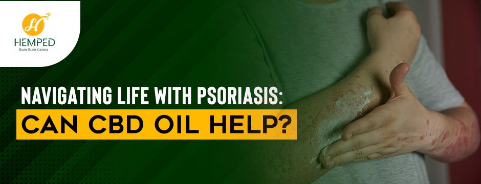 Navigating Life With Psoriasis: Can CBD Oil Help? - Urhemped