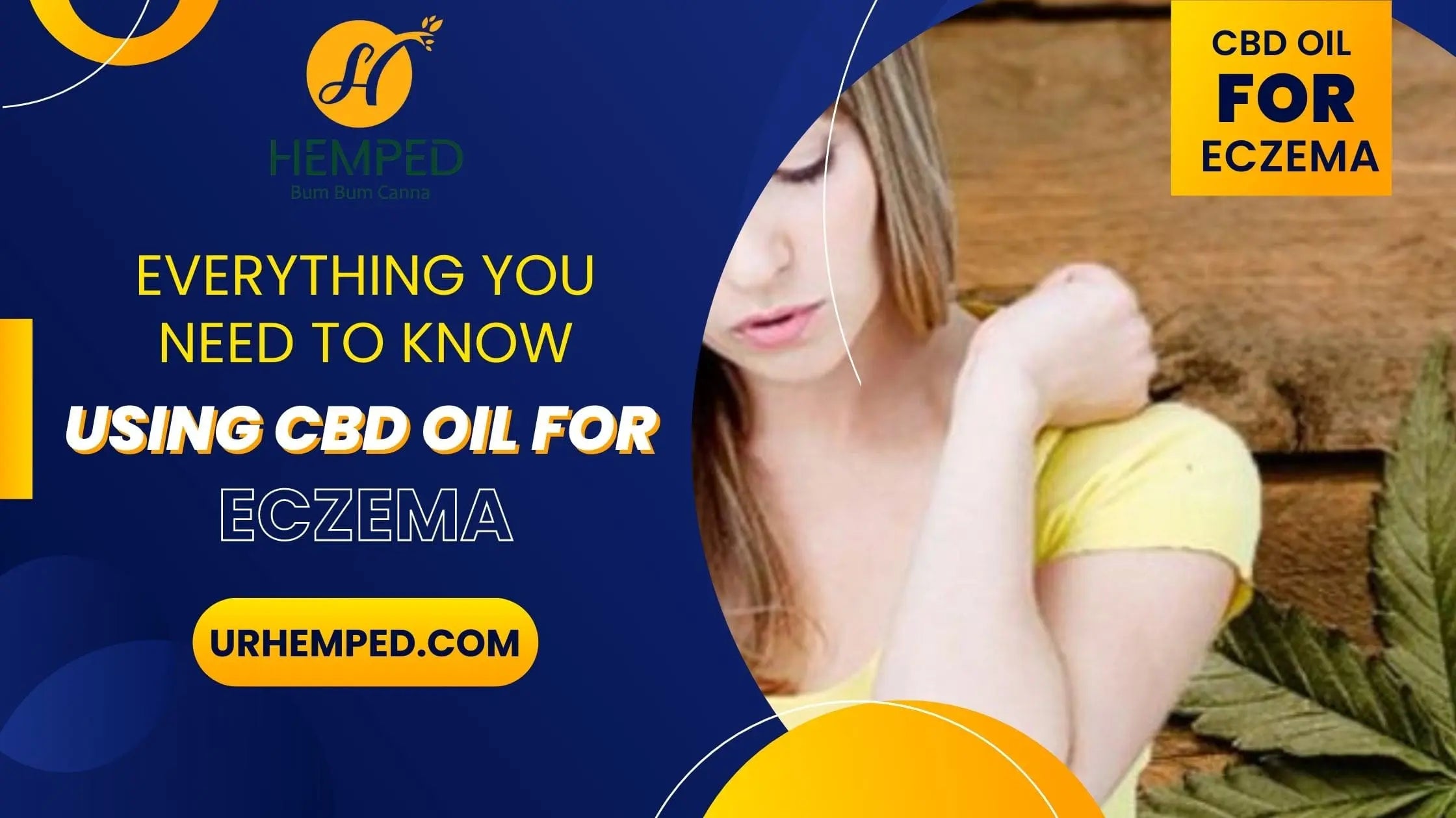 Everything You Need To Know About Using CBD Oil For Eczema